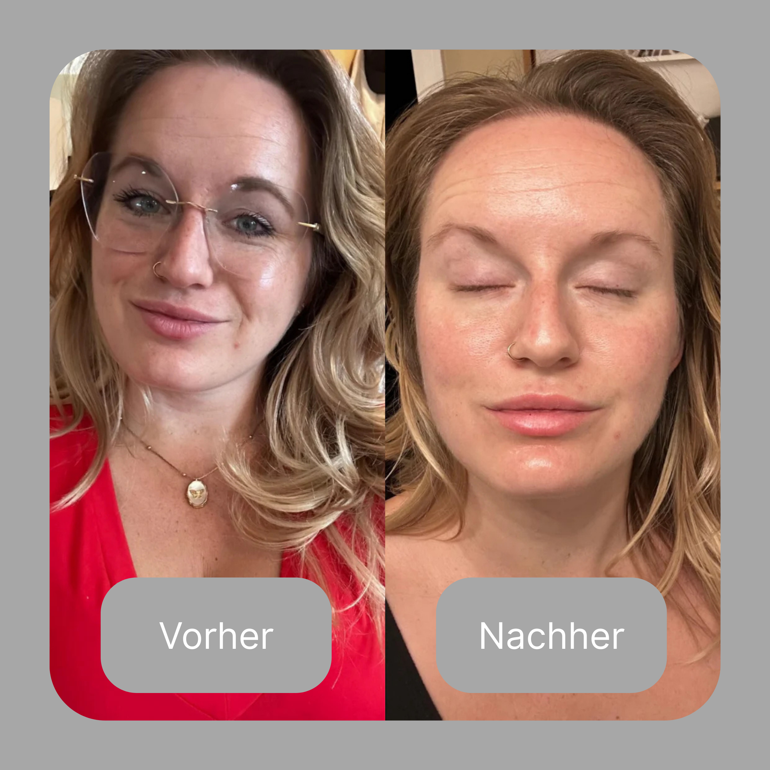 Collagen Recovery Mask