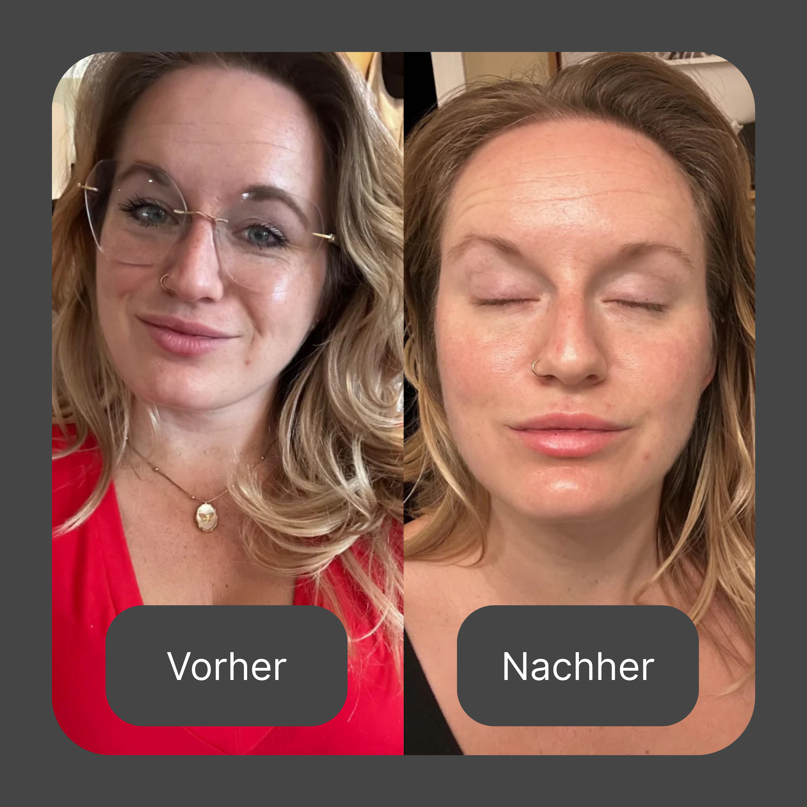 Collagen Recovery Mask