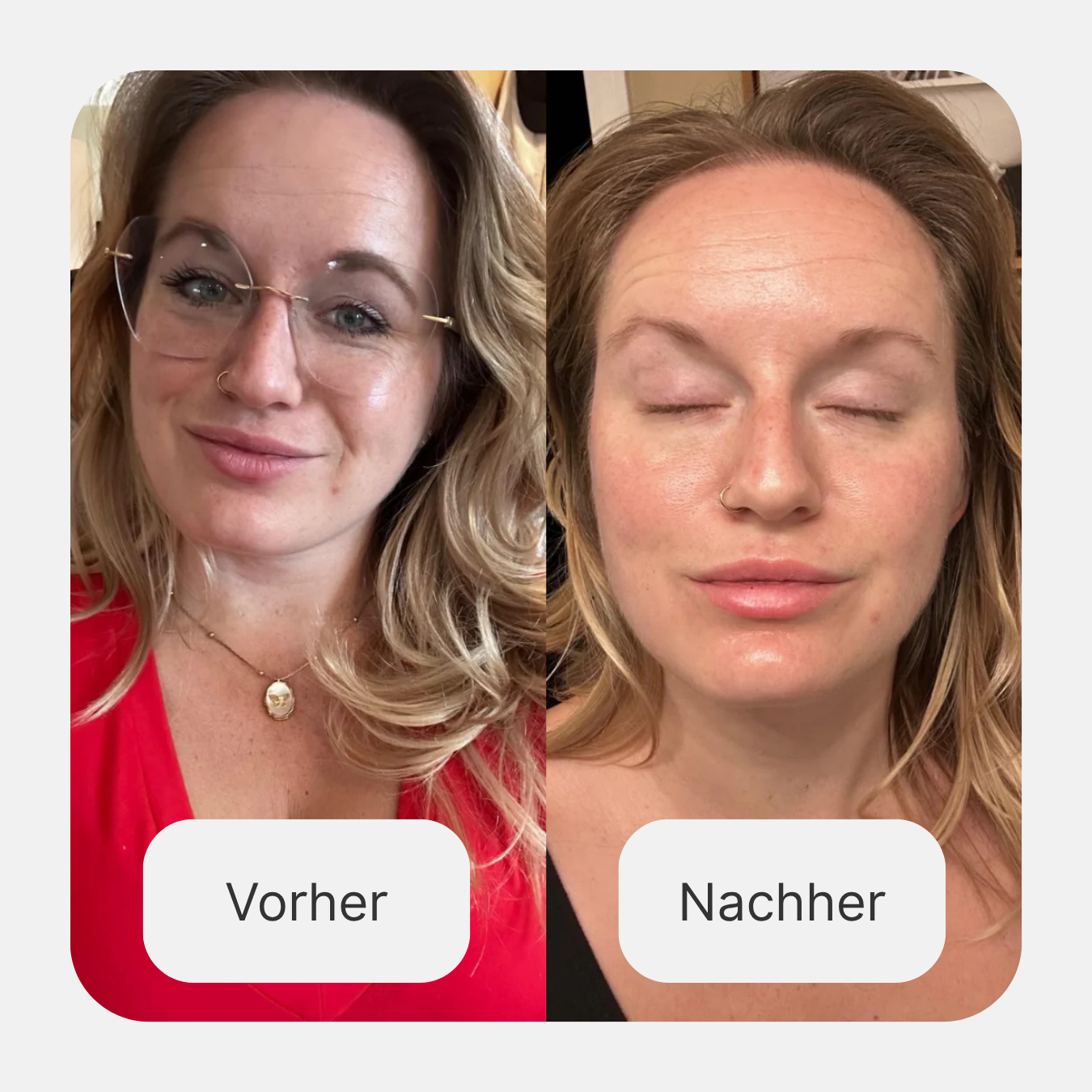 Collagen Recovery Mask